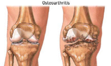 本頁圖片/檔案 - physio2