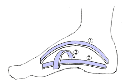 本頁圖片/檔案 - flatfeet_arch