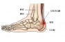 foot