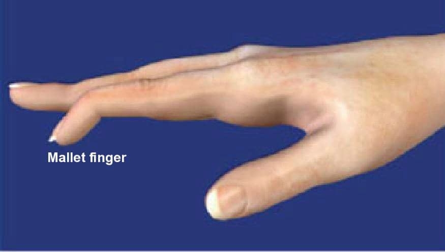 本頁圖片/檔案 - Mallet_(4)