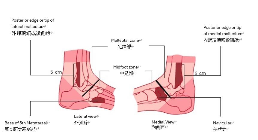 本頁圖片/檔案 - Ankle2