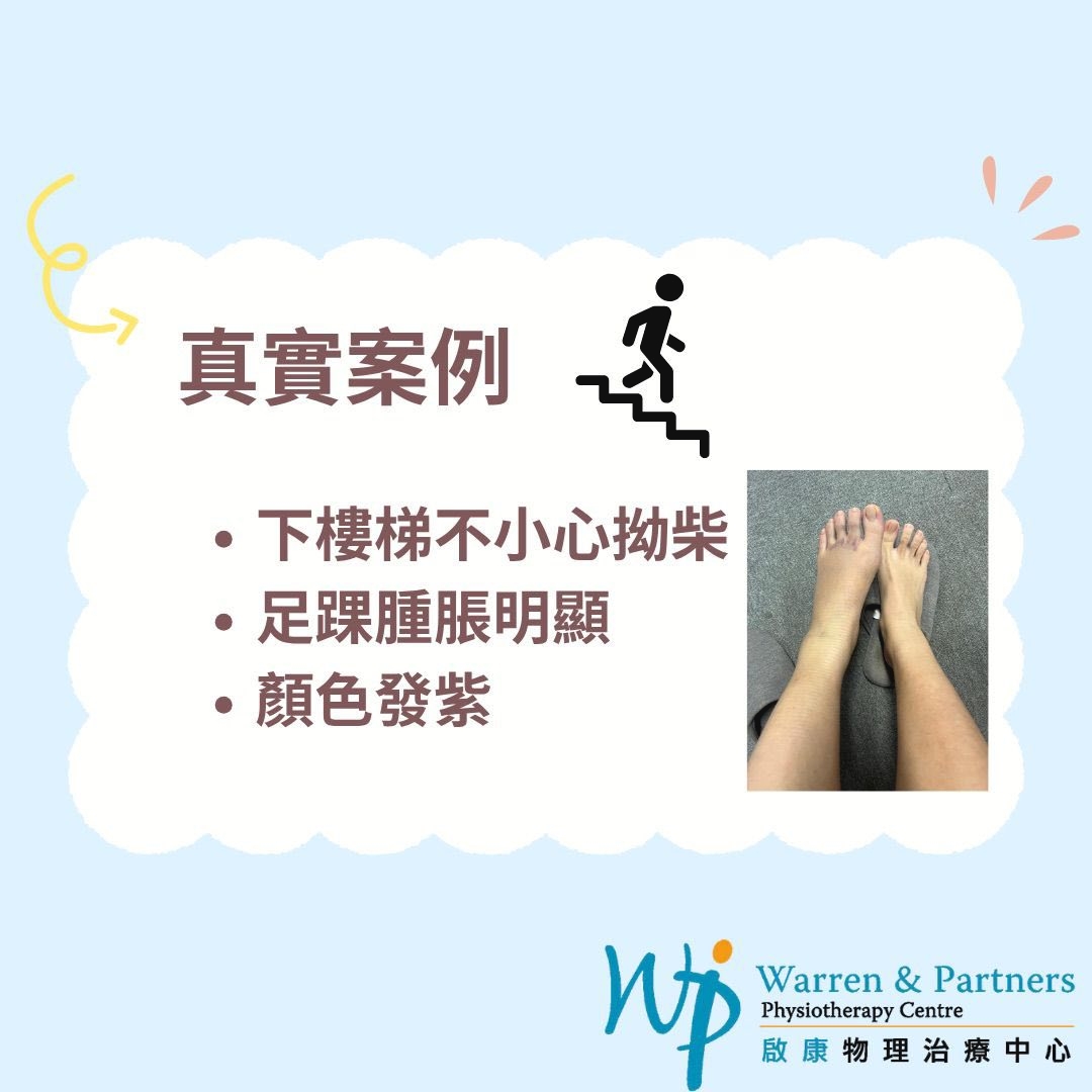 本頁圖片/檔案 - Ankle4